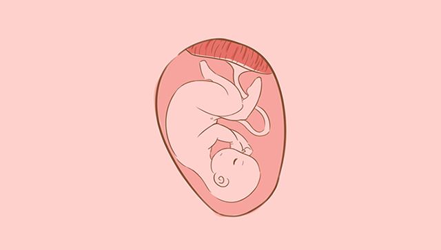 即使產檢正常，胎兒也有可能患有這幾種疾病，媽媽要知道 親子 第4張