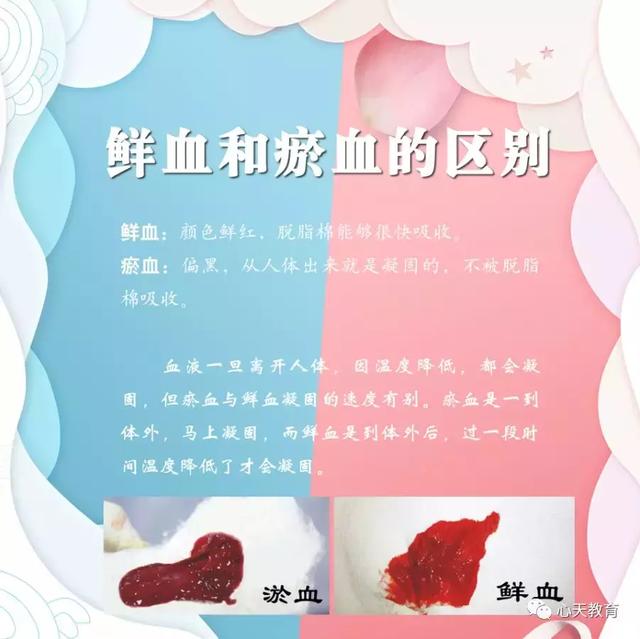 医学认为万病之源是血液循环不畅,血液循环不畅的理由是因为瘀血堵塞