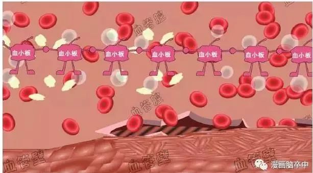 每年120萬人死於這種病…… 健康 第20張