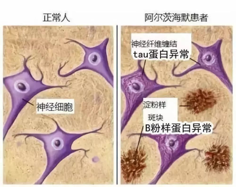 老年人口过多_湖南省老年人口大省(2)