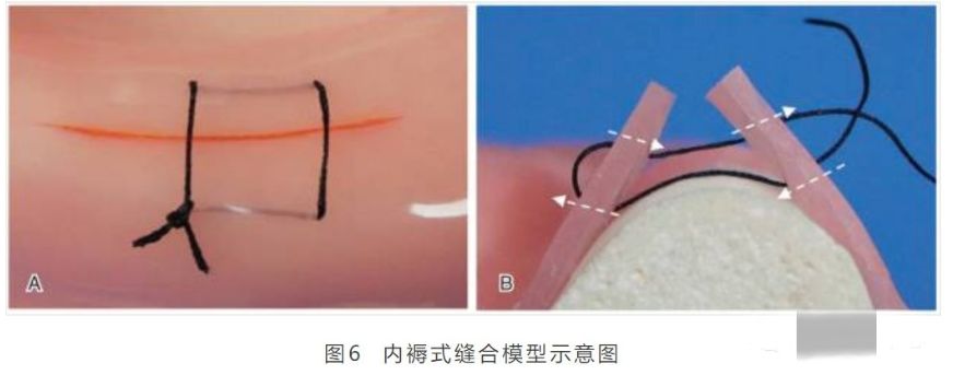 关于口腔黏膜缝合的所有问题集合