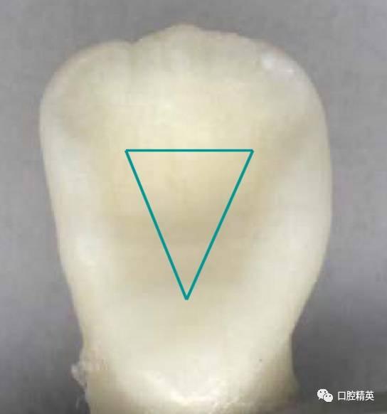 详解各牙位的开髓整理版