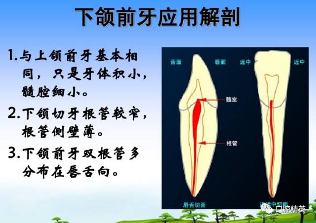 详解各牙位的开髓整理版