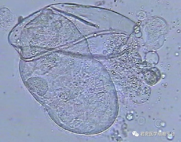 罕见的"花粉孢子—埃及血吸虫卵