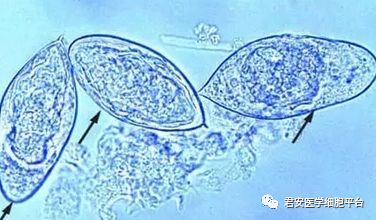 罕见的"花粉孢子"——埃及血吸虫卵