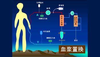 第五,外周血干细胞单采:可用于自体,异体外周血造血干细胞移植