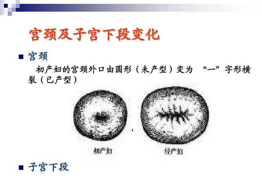 女性做过人工流产,检查时医生会检查出来吗?_宫颈口