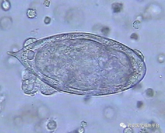 罕见的"花粉孢子"——埃及血吸虫卵