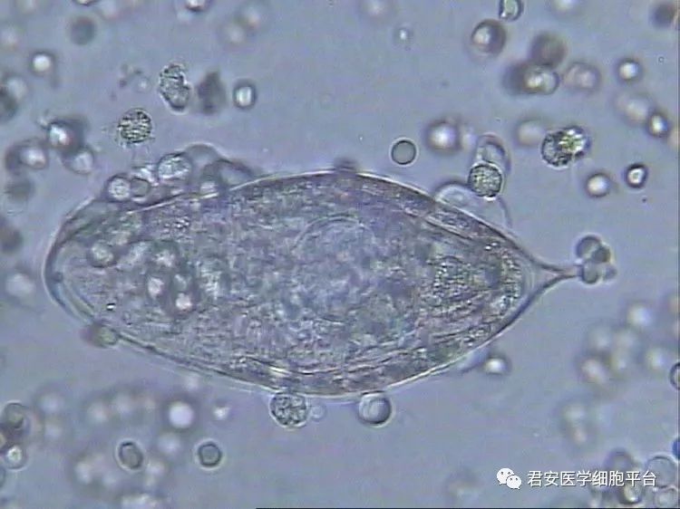 罕见的"花粉孢子—埃及血吸虫卵