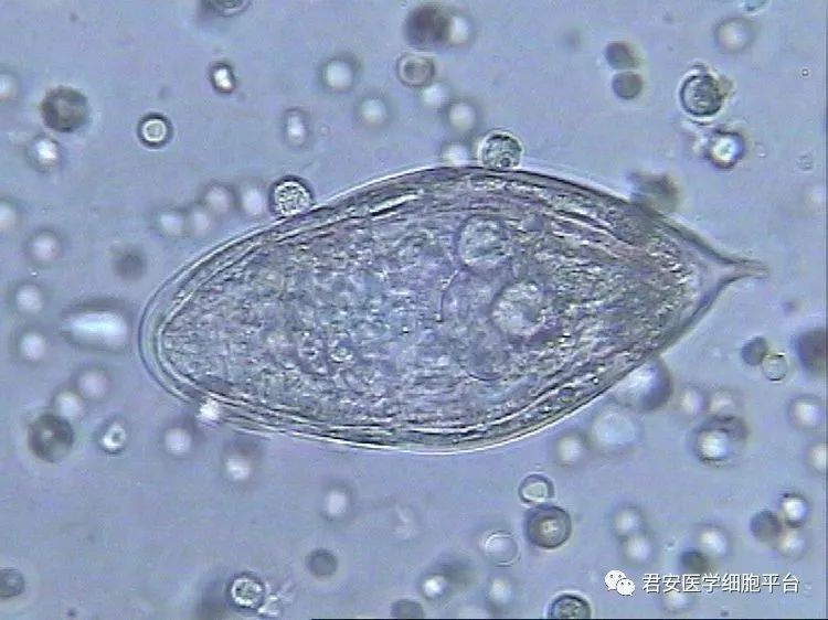 罕见的"花粉孢子"——埃及血吸虫卵
