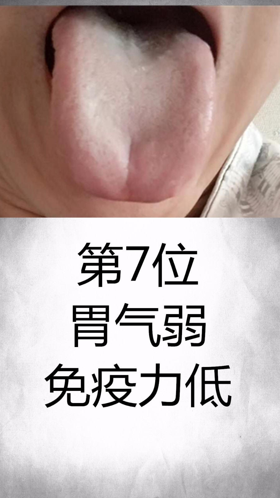 舌诊哥:舌诊知健康,教大家学会看舌象系列一_脾胃