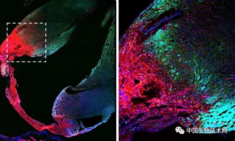 小鼠心肌梗塞后心脏中的疤痕.疤痕组织(红色),心肌细胞(绿色).
