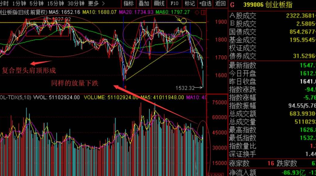 w底形态特征