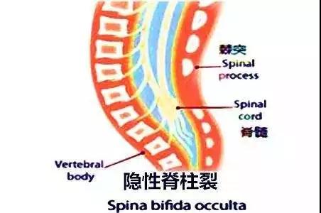 成人遗尿怎么办