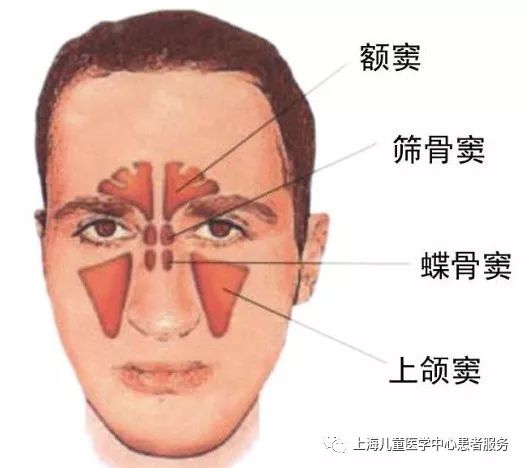 【健康大講堂】打噴嚏、流鼻涕，是感冒還是過敏性鼻炎？ 健康 第10張