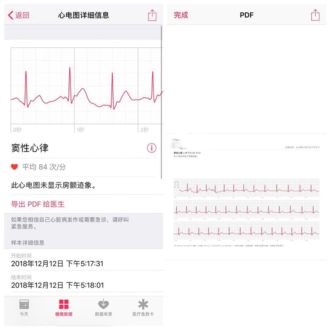 apple watch 的 ecg 心电图究竟怎么样,我们上手实测了一下