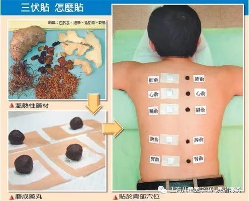 【健康大講堂】打噴嚏、流鼻涕，是感冒還是過敏性鼻炎？ 健康 第17張