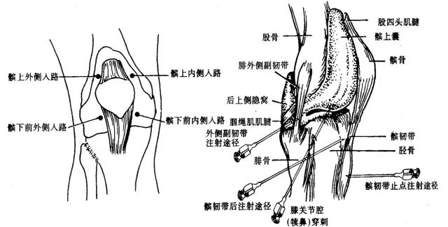 髋膝踝肩肘腕关节穿刺技巧图文并茂