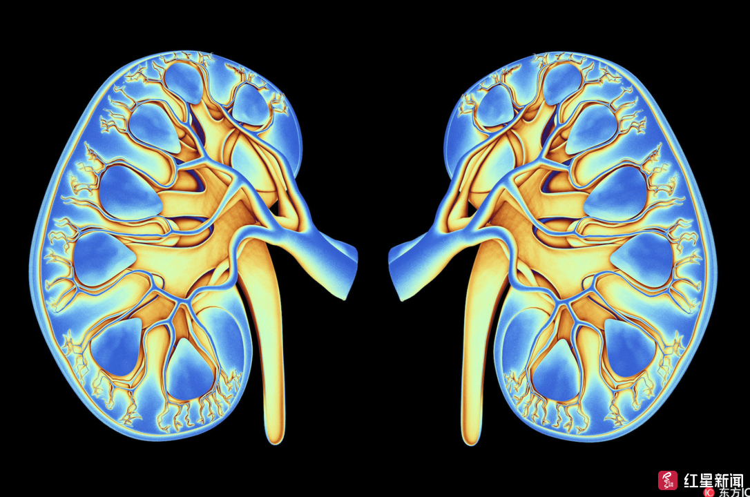 人体肾脏示意图(东方ic资料图)