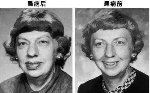 封面 | 還以為是青春抵不過中年發福？檢查結果讓人措手不及 健康 第5張