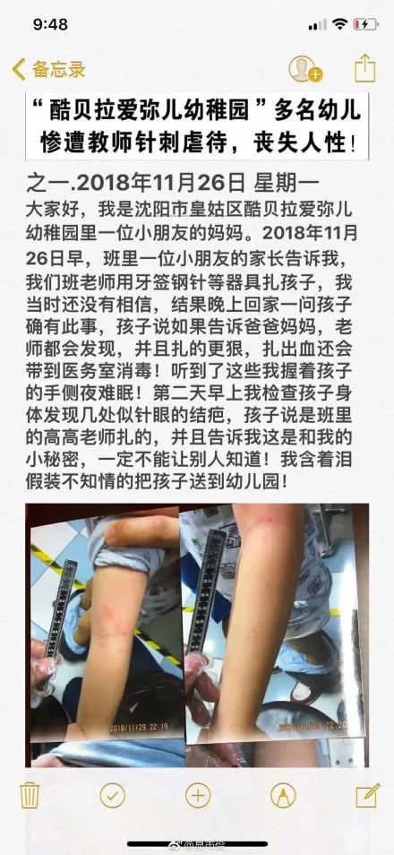 皇姑区多名幼童遭老师用牙签,钢针扎身体,还被关进厕所……警方回应3