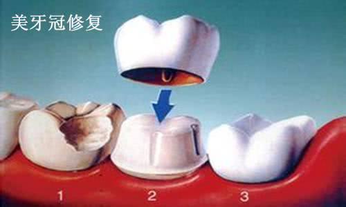 看完这篇文章还来得及拯救