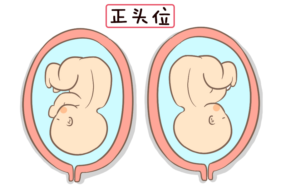 当然除了这两种比较常见的顶先露的正常胎位外,还有臀先露,肩先露等