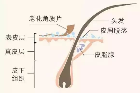 这样洗头,头发会越洗越少!_头皮