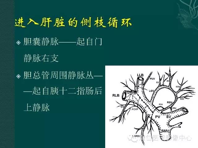 推荐ctpv门静脉海绵样变性