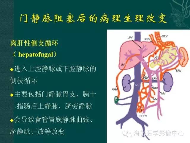 推荐ctpv门静脉海绵样变性