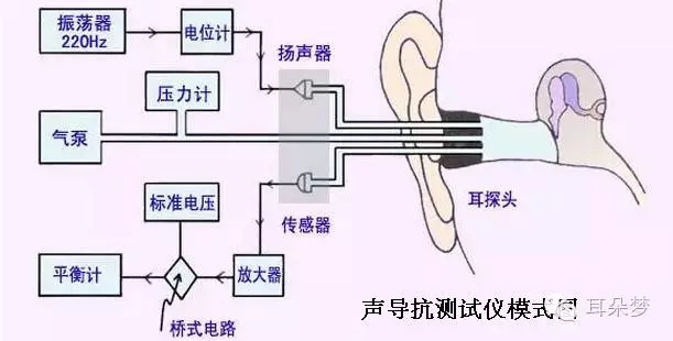 鼓室声导抗图怎么看