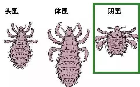 李锦阳介绍,阴虱是一种寄生于人体毛发的寄生虫,常见于阴部,阴虱远看