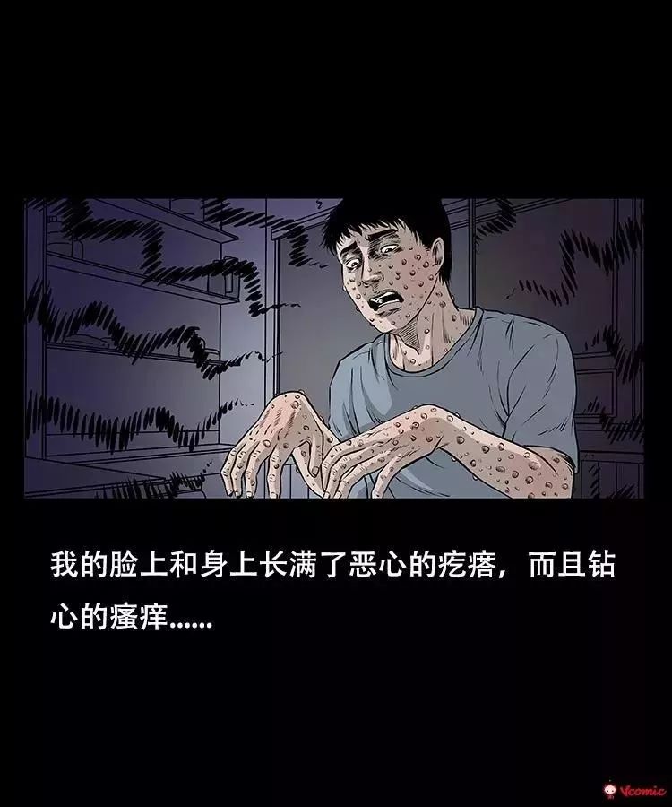 每日漫画《怪病》出现奇怪恶心的疙瘩,密恐别点!