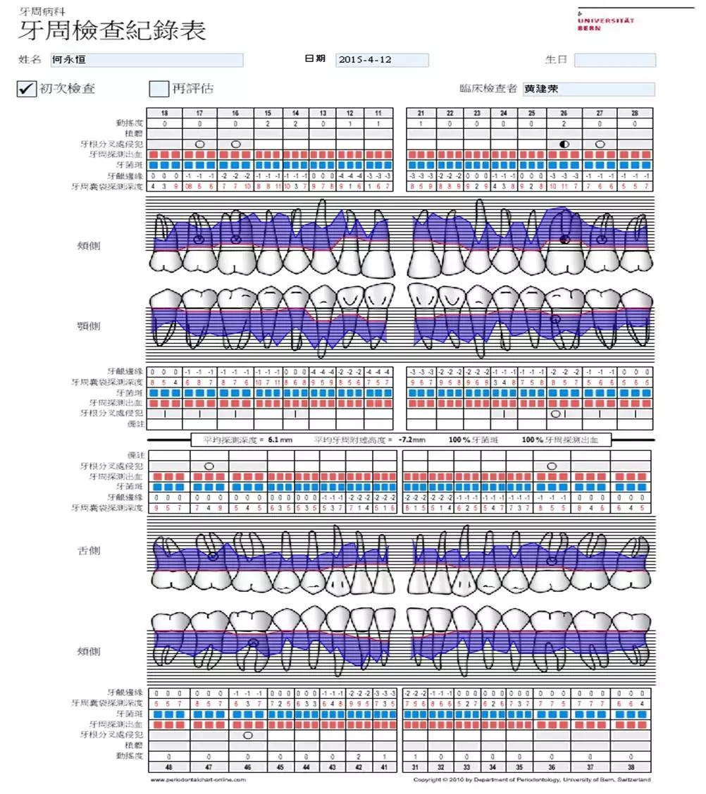 牙周检查记录表