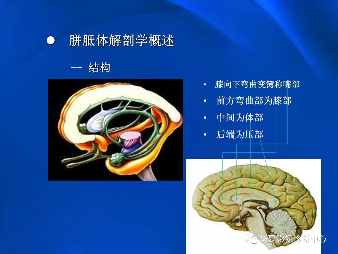 胼胝体病变影像学表现