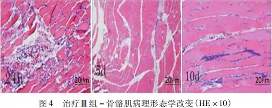 基础研究|不同浓度医用三氧对兔骨骼肌损伤组织学与il