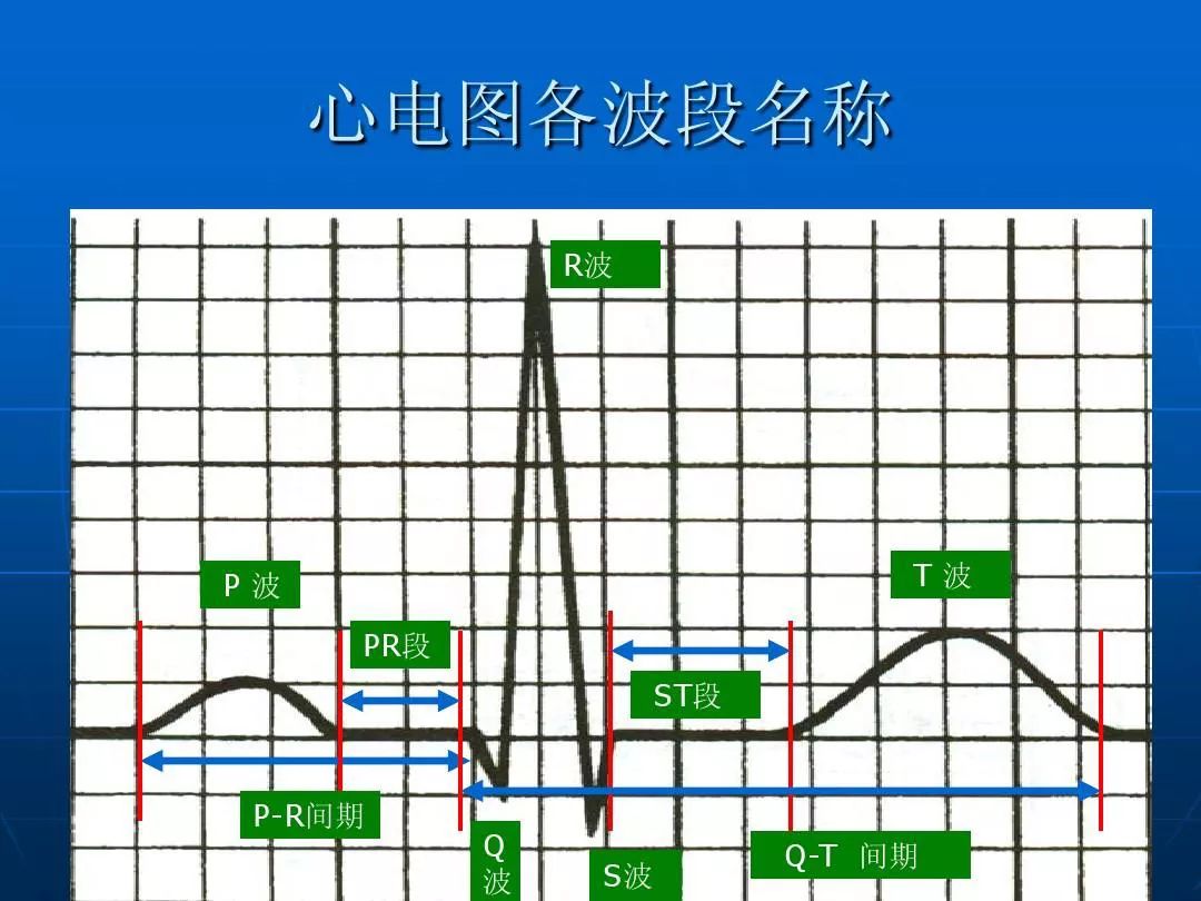 花费少,几分钟就可以作出诊断,但是大多数人往往不懂心电图纸上弯弯曲