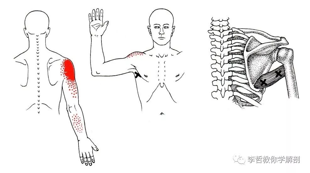 五十肩的疼痛如何有效缓解?