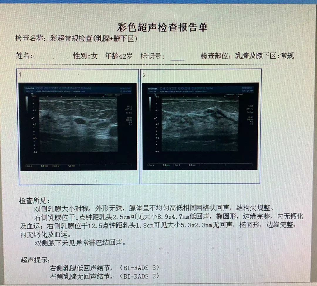 很多患者会拿着乳腺检查的报告单寻问医生:"这次的检查结果是否正常?