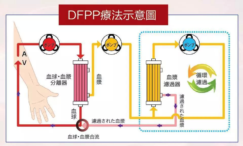 血液净化技术的基本原理_血液净化技术的互补性   血液净化技术在原有技术基础上不断发展和(3)