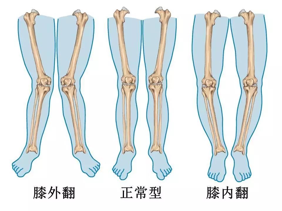 x型,o型腿怎么办?关于腿型的7个谣言,第1条就有人中招!