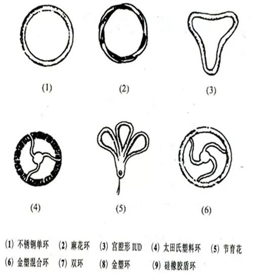 国内外常用的几类节育器 带铜t型节育器 以聚乙烯为t型支架,在纵臂或