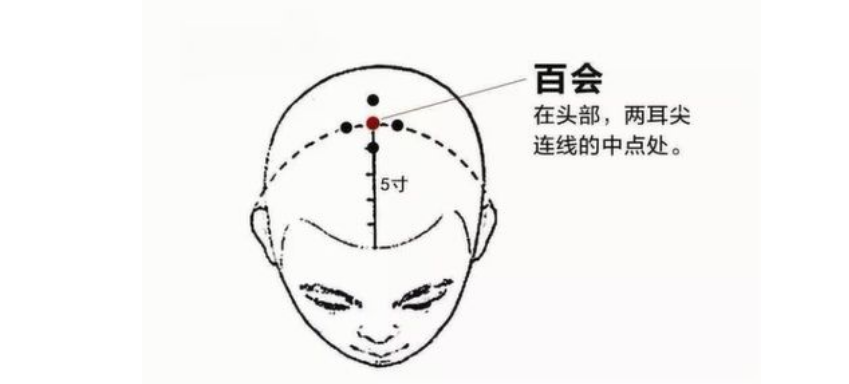 第一个,百会穴,在头部,两耳尖连线的终点处.