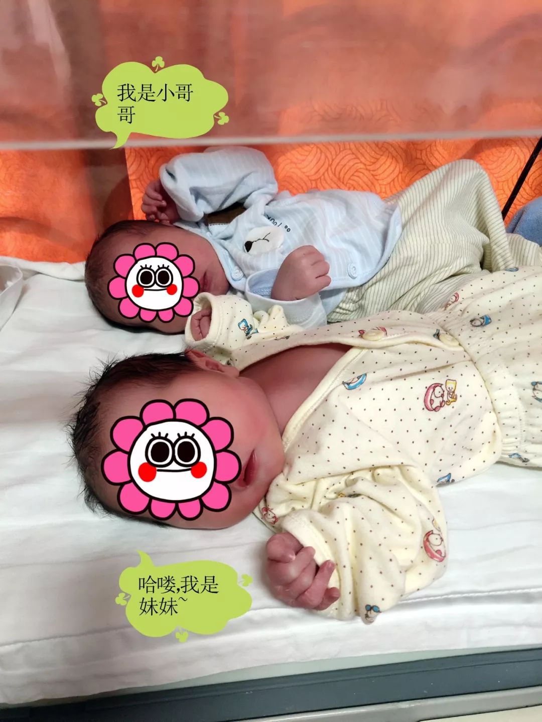 双胎顺产我院重度子痫前期妊高症产妇平安顺产龙凤宝宝