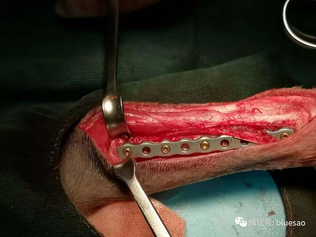 【病例分享】雪纳瑞桡尺骨远端骨折,prcl锁定骨板内固定拆板手术病例
