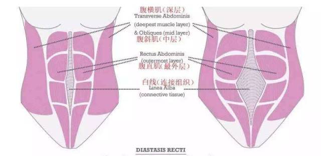 防妊娠纹的是什么原理_妊娠纹是什么样子图片(2)