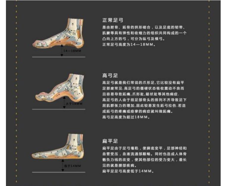 95扁平足脚印面积一般很大,不过根据扁平足程度不同,看是否有治疗