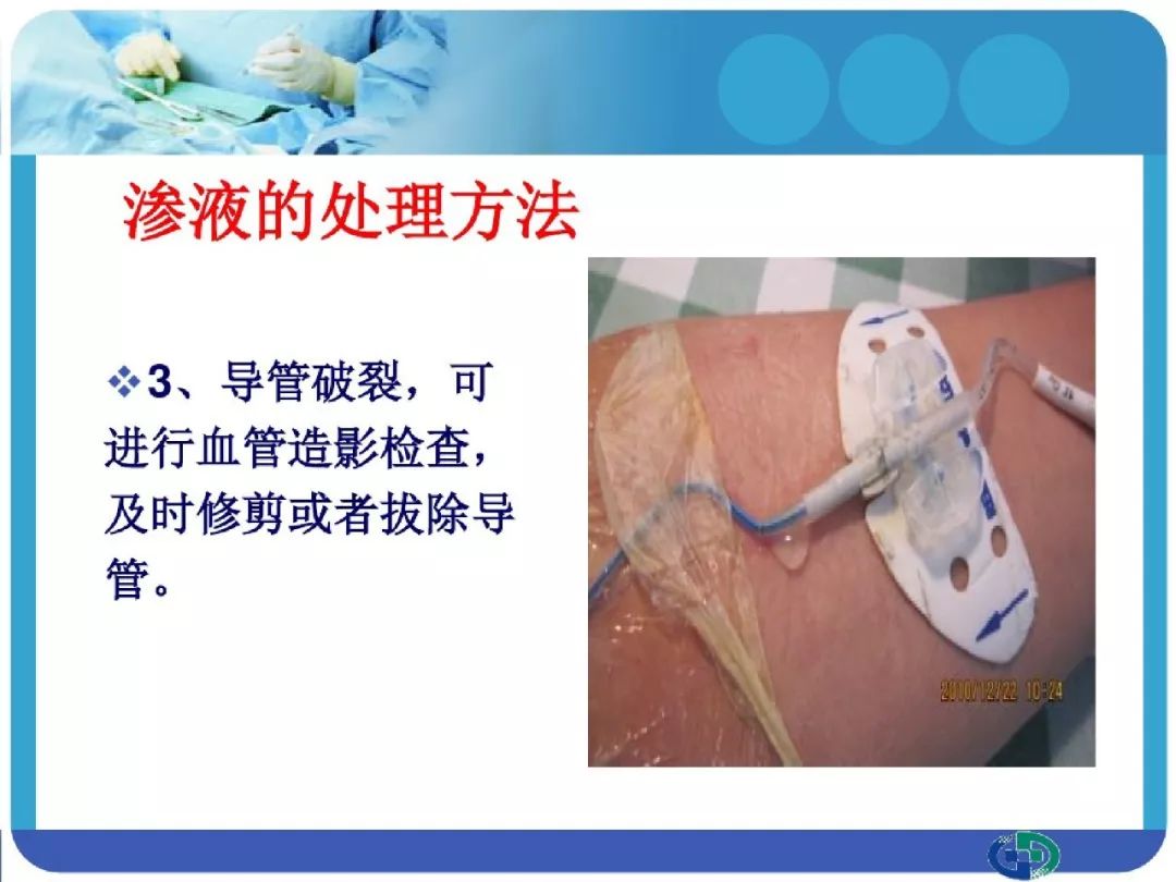 【ppt】picc穿刺点渗液与皮肤过敏的处理