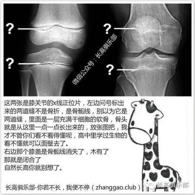 怎么看骨头闭合没闭合图片