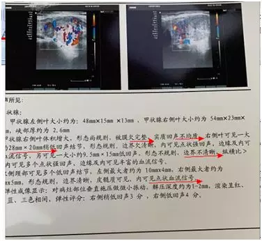 甲状腺结节超声报告分三部分, 这么看简单易懂!
